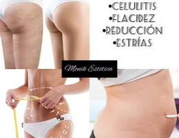 Monik Estetica -tratamientos Faciales y Corporales