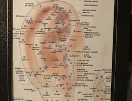 Auriculoterapia /Acupuntura