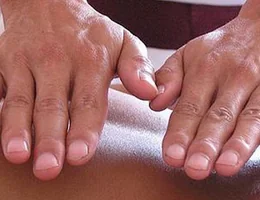 Acupuntura,Moxibustion,masaje(tuina)qigongterapia