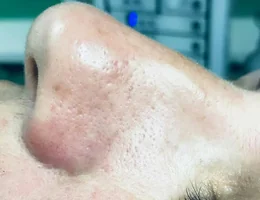 Micropigmentación Cejas y labios